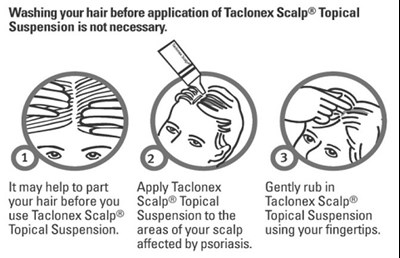 3 Scalp Images (3 Scalp Images)